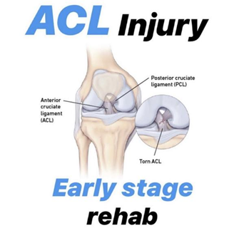 ACL injury image